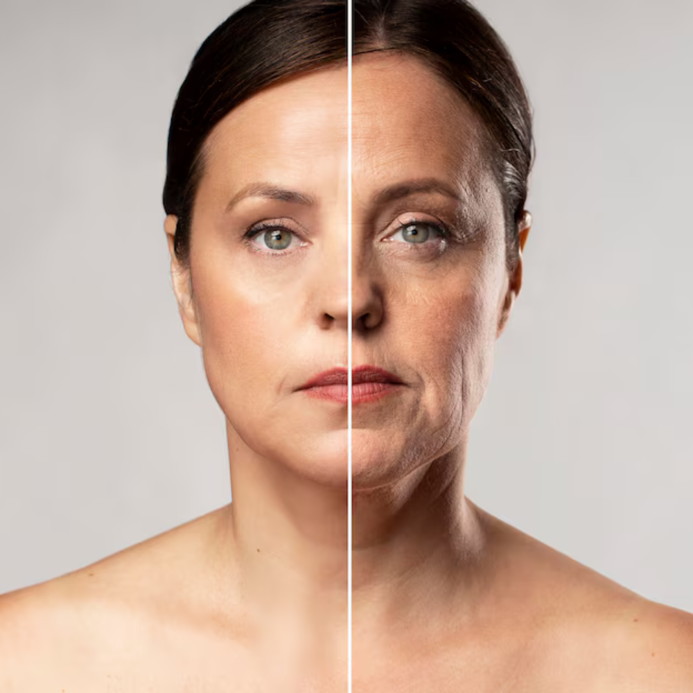 rejuvenescimento Dra. Monica